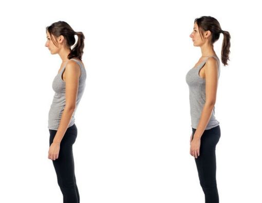 Amankah Pengidap Skoliosis Hanya Menggunakan Brace Skoliosis?