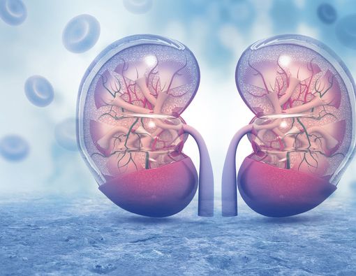 Catat! Ini Cara Mudah untuk Mencegah Batu Ginjal