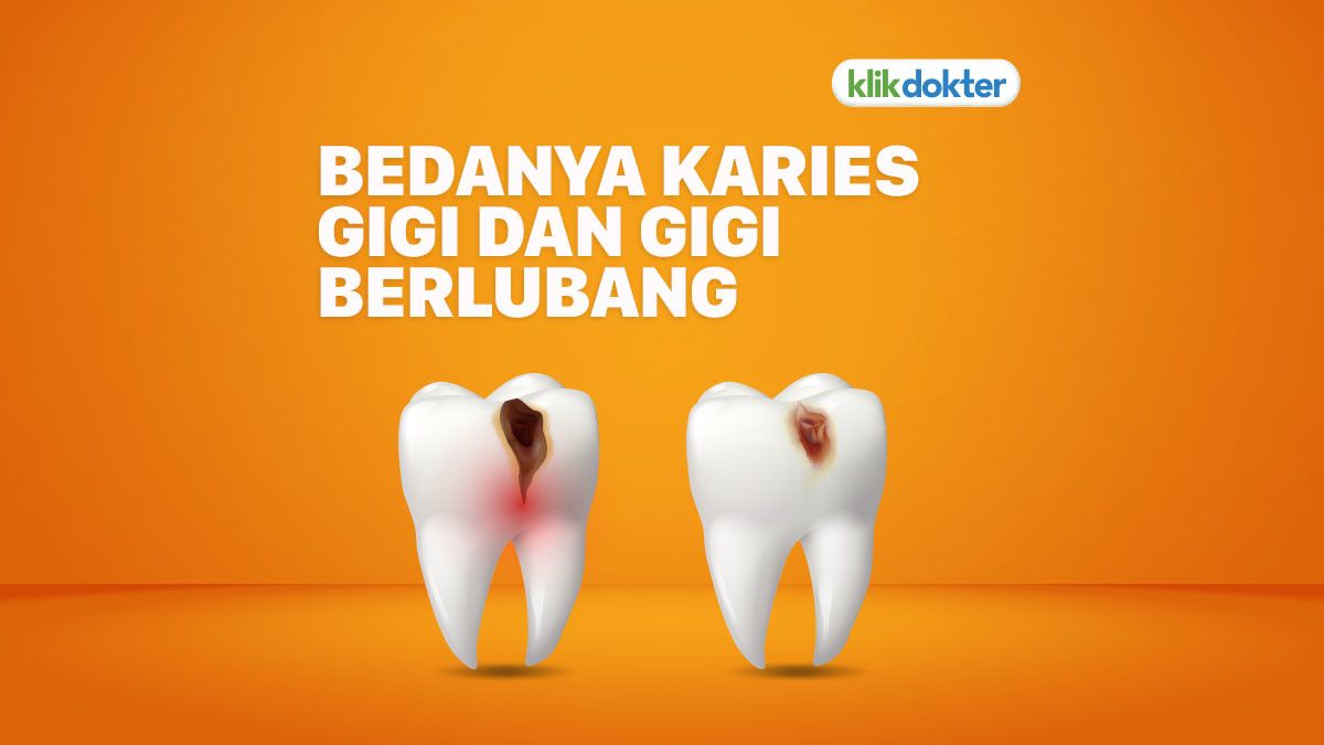 Karies Gigi dan Gigi Berlubang, Apa Bedanya?