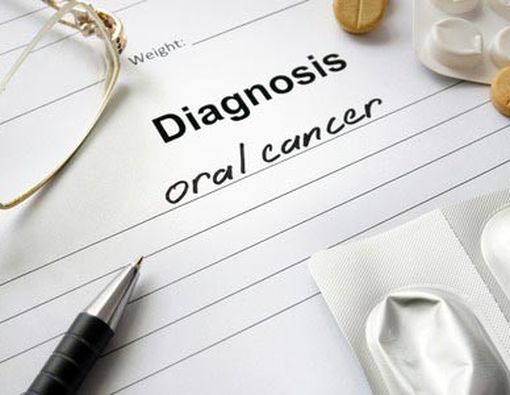 Akibat Jarang Sikat Gigi: Kanker Mulut!