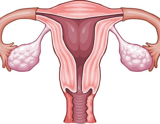 Penebalan Dinding Rahim, Apakah Tanda Awal Kanker?