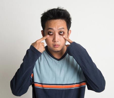 Penyebab Muncul Lingkaran Hitam di Sekeliling Mata