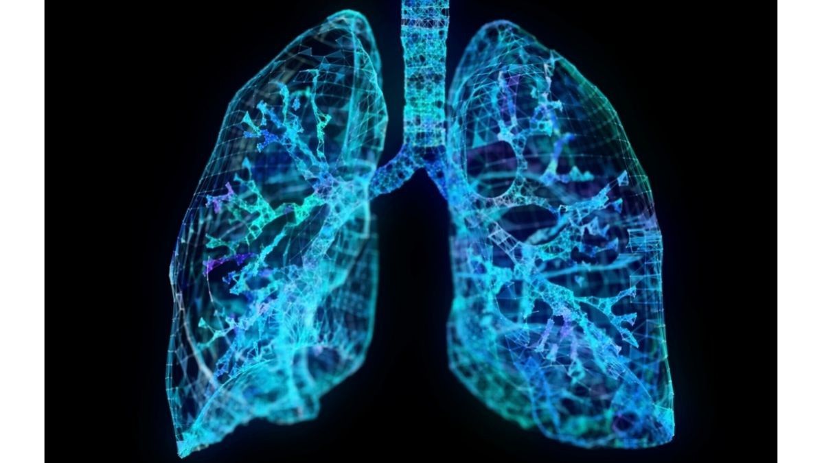 Mengenal Torakosintesis, Prosedur Sedot Cairan di Paru