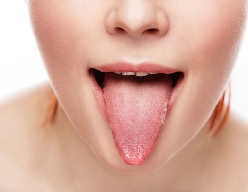 Warna Lidah Bisa Mendeteksi Kondisi Kesehatan Anda