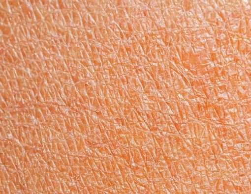 Perbedaan Garis Halus dan Kerutan yang Perlu Anda Tahu