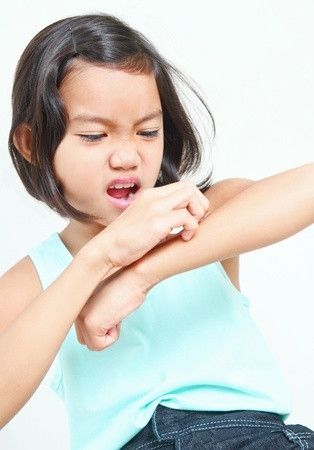 Menangani Alergi Makanan Pada Anak