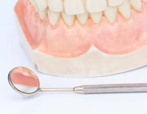 4 Penyebab Erosi Gigi