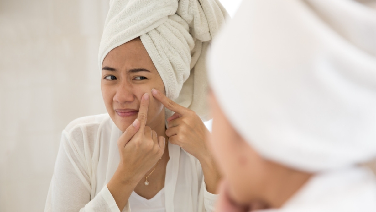 Suka Memencet Jerawat Bisa Picu Kanker Kulit