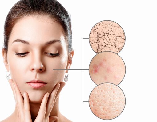 Deretan Masalah Kulit yang Sering Muncul di Musim Hujan