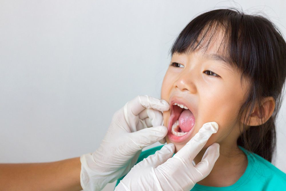 Waspada, Polio Bisa Berdampak pada Kesehatan Gigi dan Mulut