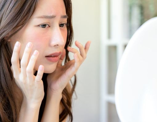 Apakah Jatuh Cinta Bisa Menyebabkan Jerawat? Ini Faktanya!