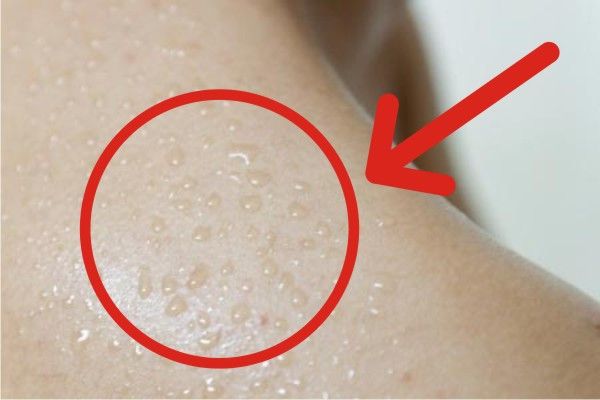 Ancaman Peningkatan Pertumbuhan Kuman pada Badan Berkeringat