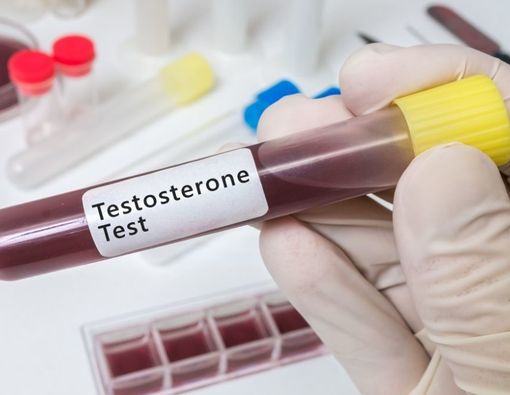 Tak Kalah Penting, Ini Peran Hormon Testosteron pada Wanita