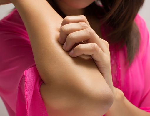 Kondisi Kulit Gatal yang Tidak Boleh Digaruk Beserta Alasannya