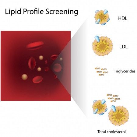 High Density Lipoprotein