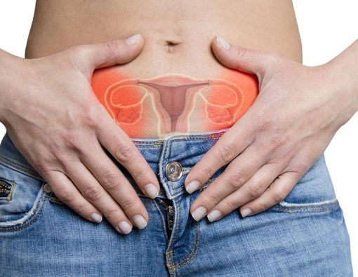 9  Penyebab Kista Ovarium pada Wanita