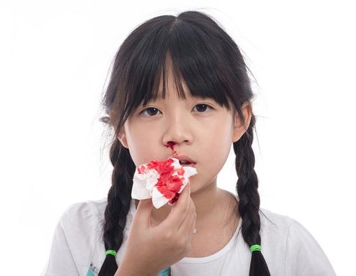 Tanda-tanda Anak yang Terkena Hemofilia