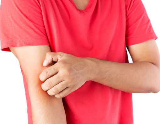 Penyakit Kulit yang Sering Dialami Pria