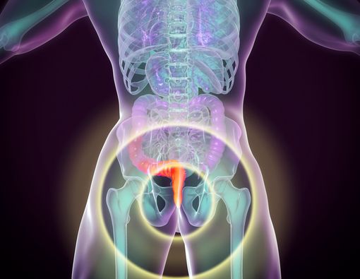 Hal-hal yang Perlu Anda Ketahui tentang Hemoroid