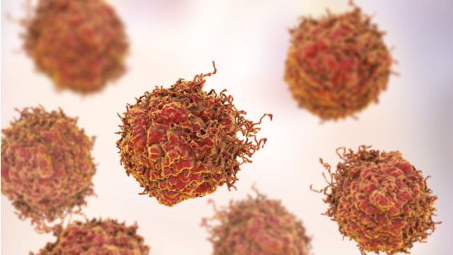 7 Komplikasi Kanker yang Perlu Anda Tahu