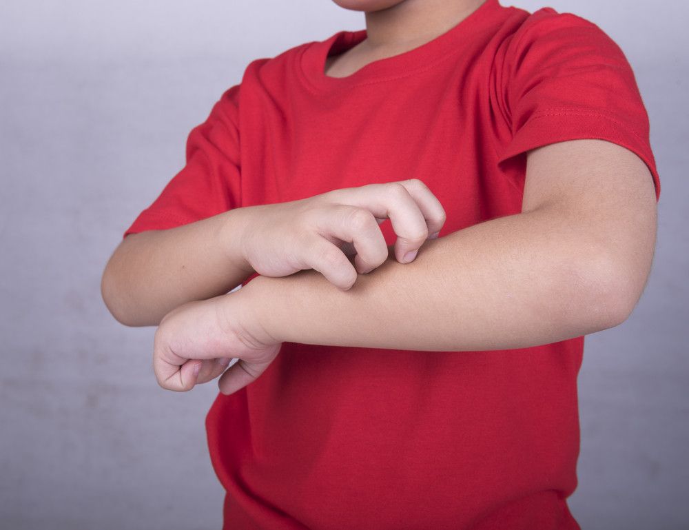 5 Kebiasaan Ini Bisa Memperburuk Alergi yang Dialami Anak
