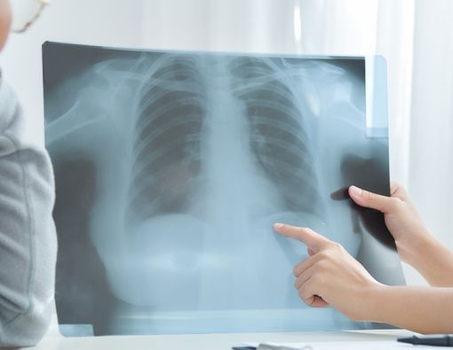 Ini Cara Diabetes Merusak Kesehatan Paru Penderitanya