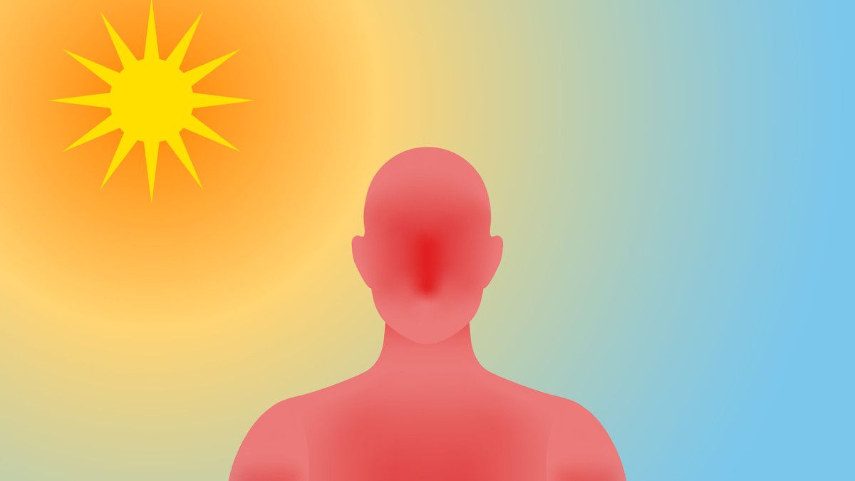 Benarkah Heatstroke Bisa Sebabkan Stroke pada Jemaah Haji?