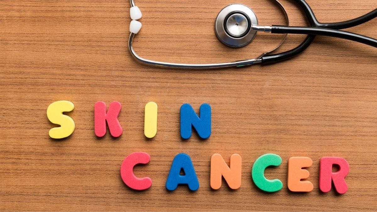 Nutrisi yang Baik Dikonsumsi Selama Perawatan Kanker Kulit