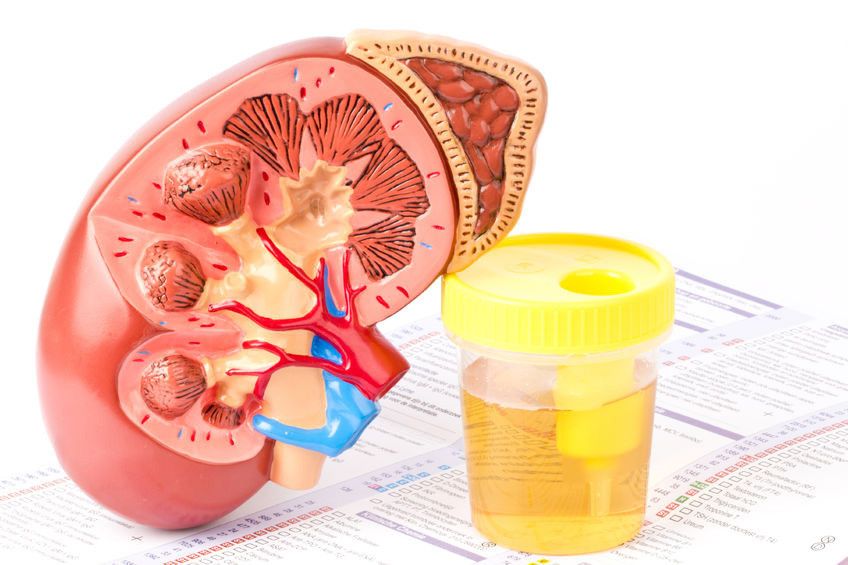 Inilah 3 Akibat Konsumsi Protein Berlebihan