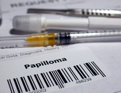 Inilah Gejala Papiloma Laring yang Perlu Diwaspadai