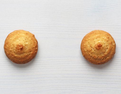 Puting Payudara Wanita Berubah Hitam, Apakah Tanda Penyakit?