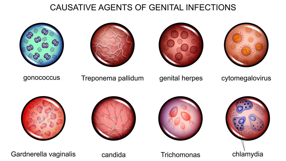 WHO Sebut Ada Satu Juta Kasus PMS Per Hari, Apa Indikasinya? KlikDokter
