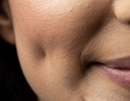 Mengenal Berbagai Jenis Lesung Pipi Manusia