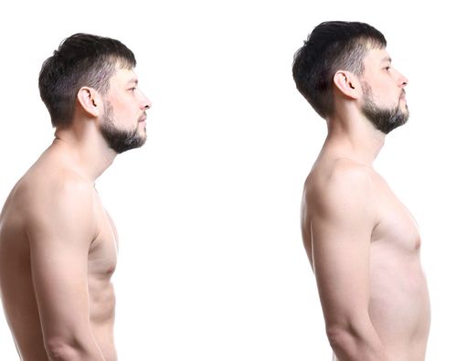 Postur Tubuh yang Baik untuk Menjaga Kesehatan Tulang Belakang