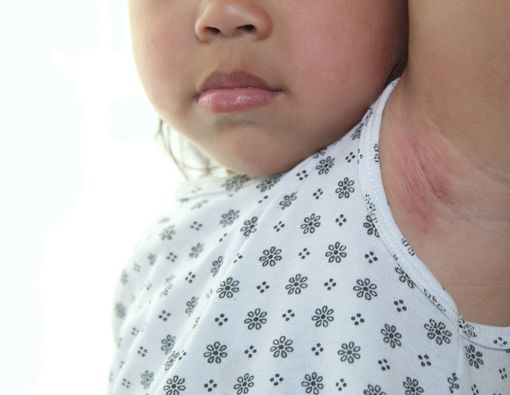 Si Kecil Bau Badan, Apa Penyebabnya?