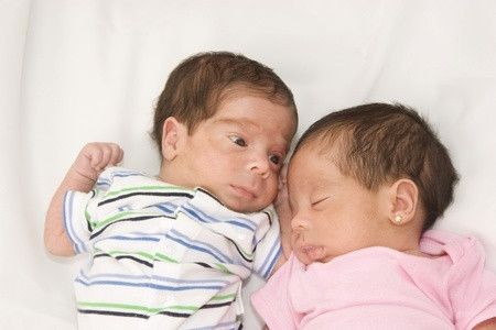 Mengenal Seluk-Beluk Kembar Siam