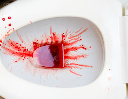 3 Penyebab Kencing Darah yang Perlu Kamu Waspadai