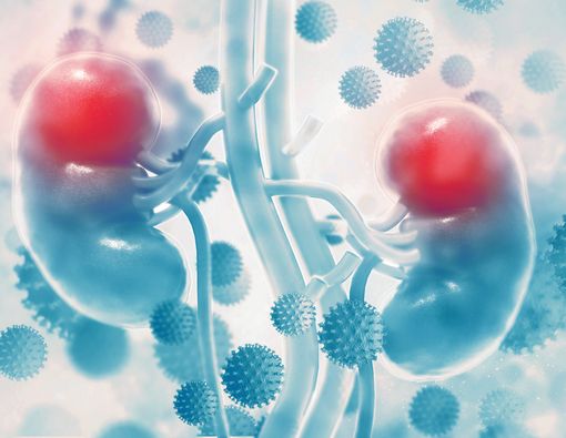 Waspadai 5 Tanda Tersembunyi Kanker Ginjal