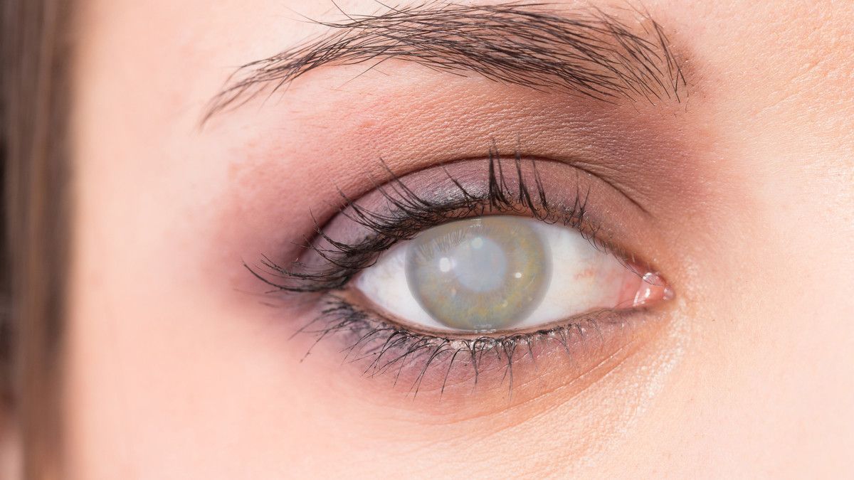 Kapan Operasi Katarak Harus Dilakukan?