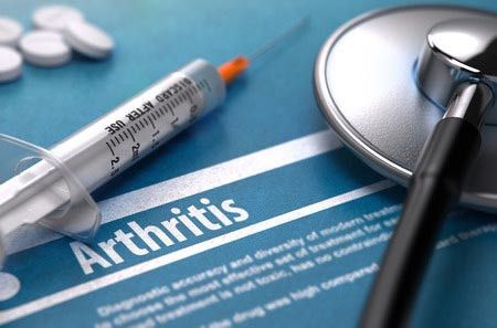 Suntikan Steroid untuk Obati Radang Sendi