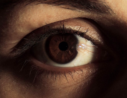 Ada Selaput Putih di Bola Mata, Berbahayakah?