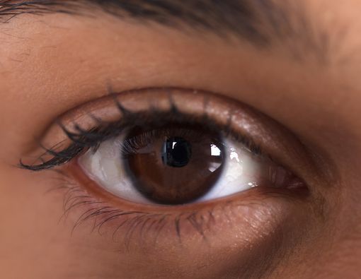 Mata Sering Kedutan, Gejala Apakah Ini?