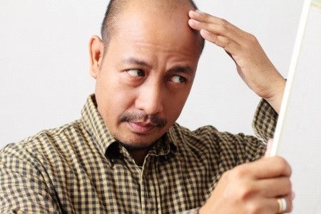 Stres Sebabkan Kebotakan