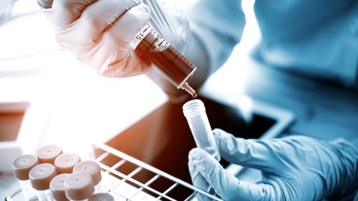 AS Uji Coba Terapi Plasma Darah untuk Mengobati Infeksi Virus Corona