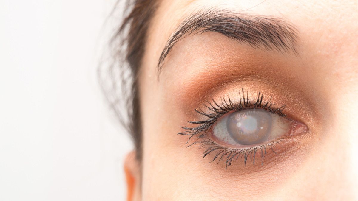 Catat! Ini Do’s and Don’ts Setelah Operasi Katarak