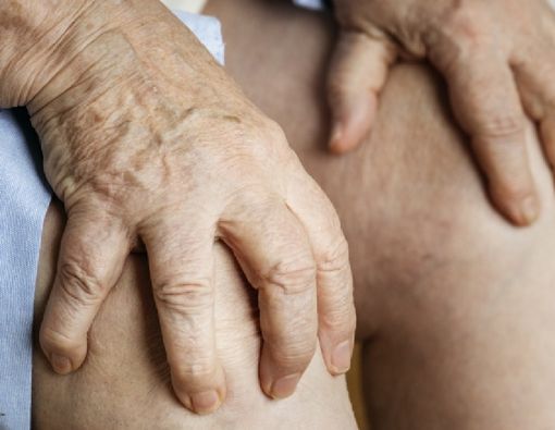 Cara Mencegah Asam Urat Kambuh pada Lansia