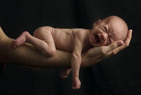 Penting! Jenis-Jenis Malnutrisi pada Si Kecil