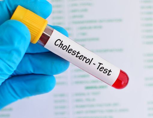 Pemeriksaan Kolesterol yang Perlu Kamu Tahu