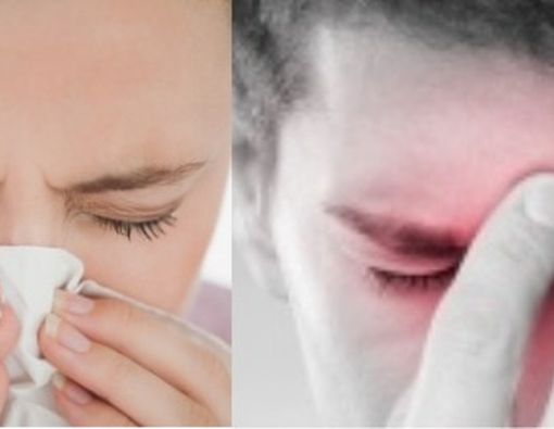 Apa Bedanya Flu dan Sinusitis?
