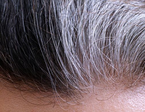 Mengulas 6 Fakta tentang Rambut Uban